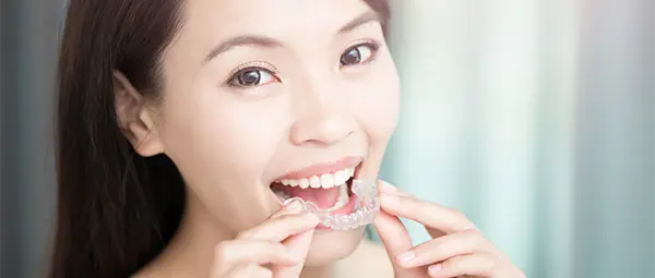free clear braces consultation in spokane